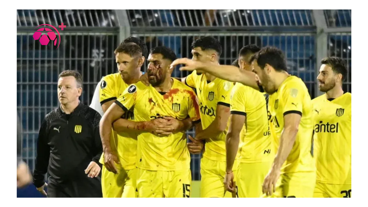 ‘Uma vergonha’: desabafa jogador do Peñarol após incidente chocante na Argentina